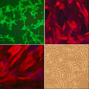 Rat Astrocytes: RA, neonatal