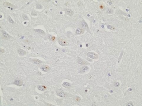 Anti-C9ORF72/C9RANT (poly-GR) Antibody, clone 5A2 clone 5A2, 1&#160;mg/mL, from rat