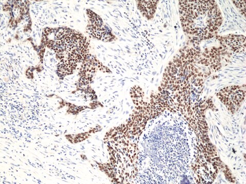 Anti-p40 (deltaNp63) Rabbit Monoclonal Antibody clone RM392, affinity purified immunoglobulin