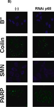 Anti-Coilin antibody, Mouse monoclonal ~1.5&#160;mg/mL, clone p&#948;, purified from hybridoma cell culture