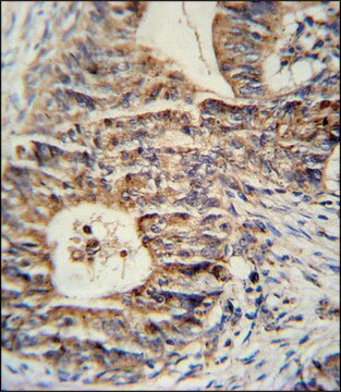 ANTI-KLHL24 (CENTER) antibody produced in rabbit IgG fraction of antiserum, buffered aqueous solution