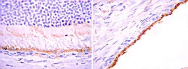 Anti-Bestrophin Antibody Chemicon&#174;, from mouse