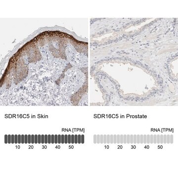 Anti-SDR16C5 antibody produced in rabbit Prestige Antibodies&#174; Powered by Atlas Antibodies, affinity isolated antibody, buffered aqueous glycerol solution