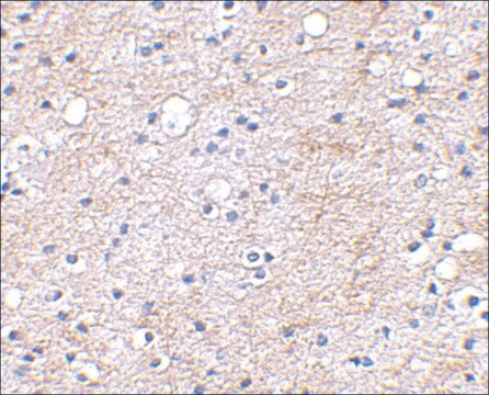 Anti-LGI1 (ab1) antibody produced in rabbit affinity isolated antibody, buffered aqueous solution