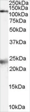 Anti-NMDA Receptor 1/GRIN1 antibody produced in goat affinity isolated antibody, buffered aqueous solution