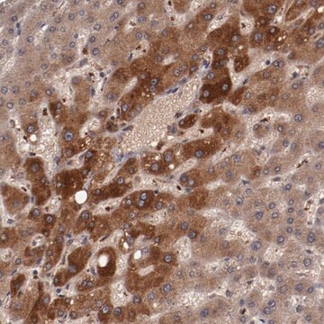 Anti-CP antibody produced in rabbit Prestige Antibodies&#174; Powered by Atlas Antibodies, affinity isolated antibody, buffered aqueous glycerol solution