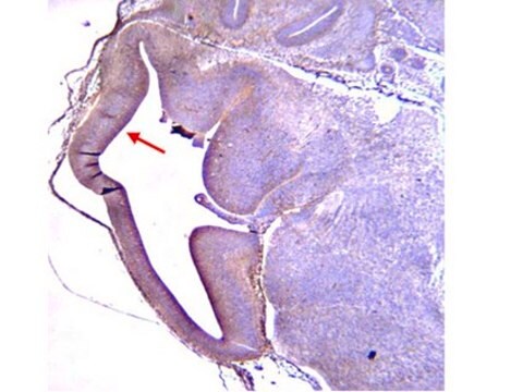 Anti-Radial Glial Cell Marker-2 Antibody, clone RC2 clone RC2, from mouse