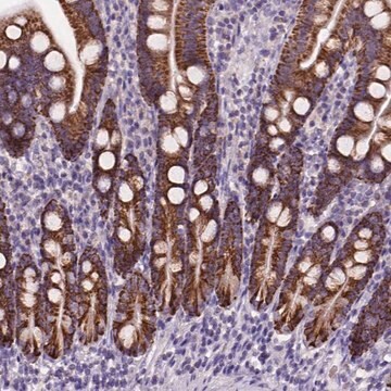 Anti-L2HGDH antibody produced in rabbit Prestige Antibodies&#174; Powered by Atlas Antibodies, affinity isolated antibody, buffered aqueous glycerol solution