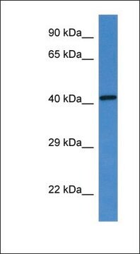 Anti-G6PC antibody produced in rabbit affinity isolated antibody