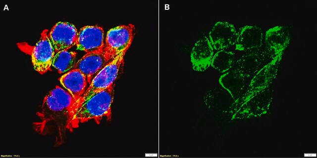 Anti-LMP1 Antibody, clone 1G6