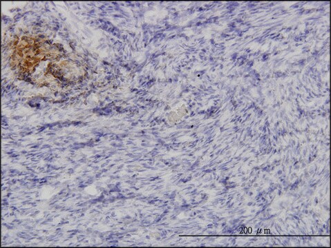 Monoclonal Anti-ANGPTL1 antibody produced in mouse clone 3A5, purified immunoglobulin, buffered aqueous solution