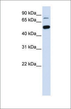 Anti-SMARCD1 antibody produced in rabbit affinity isolated antibody