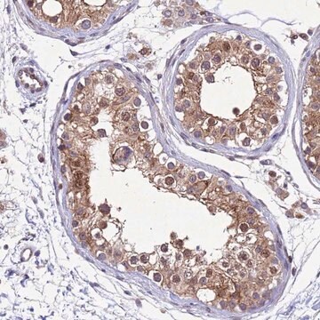 Anti-TBK1 antibody produced in rabbit Prestige Antibodies&#174; Powered by Atlas Antibodies, affinity isolated antibody, buffered aqueous glycerol solution