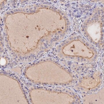 Anti-SLC26A4 antibody produced in rabbit Prestige Antibodies&#174; Powered by Atlas Antibodies, affinity isolated antibody, buffered aqueous glycerol solution