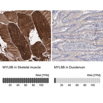 Anti-MYL6B antibody produced in rabbit Prestige Antibodies&#174; Powered by Atlas Antibodies, affinity isolated antibody, buffered aqueous glycerol solution