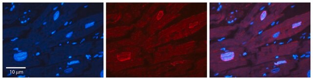 Anti-ERF, (N-terminal) antibody produced in rabbit affinity isolated antibody