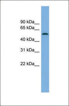 Anti-GLCCI1 antibody produced in rabbit affinity isolated antibody