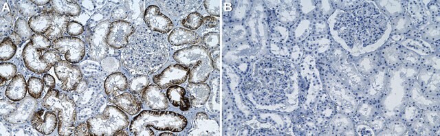 Anti-MCT8/SLC16A2 Antibody, clone 1I9 ZooMAb&#174; Rabbit Monoclonal recombinant, expressed in HEK 293 cells