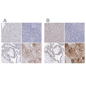 Anti-NRAP antibody produced in rabbit Prestige Antibodies&#174; Powered by Atlas Antibodies, affinity isolated antibody, buffered aqueous glycerol solution