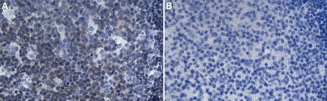 Anti-FPR1 Antibody, clone 1D14 ZooMAb&#174; Rabbit Monoclonal recombinant, expressed in HEK 293 cells