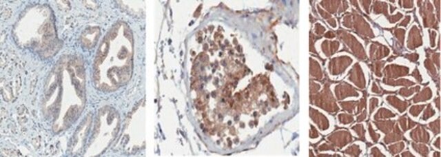 Anti-GMPR Antibody from rabbit, purified by affinity chromatography