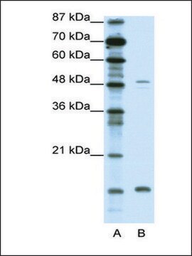 Anti-FBN1 antibody produced in rabbit affinity isolated antibody