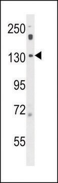 ANTI-POTEF (CENTER) antibody produced in rabbit IgG fraction of antiserum, buffered aqueous solution