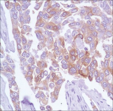 Anti-TAU antibody, Rabbit monoclonal recombinant, expressed in proprietary host, clone SP70, affinity isolated antibody