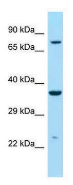 Anti-IDUA (C-terminal) antibody produced in rabbit affinity isolated antibody