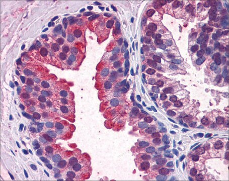 Anti-KEAP1 (AB1) antibody produced in rabbit affinity isolated antibody