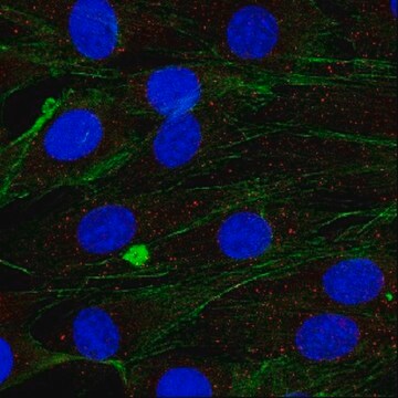 Anti-Myoferlin Antibody, clone 159 culture supernatant, clone 159, from mouse