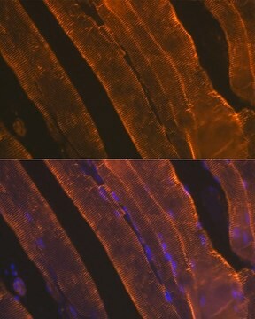 Anti-&#945;-Actin-1 (ATCA1) antibody produced in rabbit