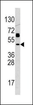 ANTI-P53(C-TERMINAL) antibody produced in rabbit affinity isolated antibody, buffered aqueous solution