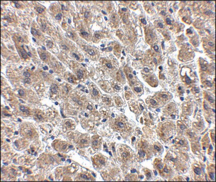 Anti-Albumin antibody produced in chicken affinity isolated antibody, buffered aqueous solution