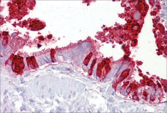 抗SCGB1A1抗体 ウサギ宿主抗体 affinity isolated antibody