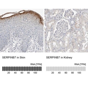 Anti-SERPINB7 antibody produced in rabbit Prestige Antibodies&#174; Powered by Atlas Antibodies, affinity isolated antibody, buffered aqueous glycerol solution