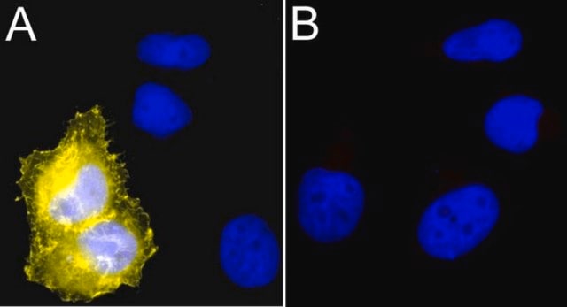 Anti-Myc Tag Antibody, clone 4A6, Alexa Fluor&#8482; 555 conjugate clone 4A6, Upstate&#174;, from mouse