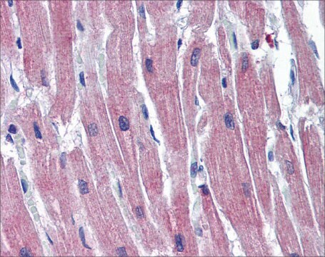 Anti-TNNI3 affinity isolated antibody