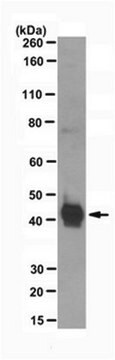 Anti-Chitinase-3-like protein 1 (YKL-40) Antibody, clone mAY clone mAY, from mouse