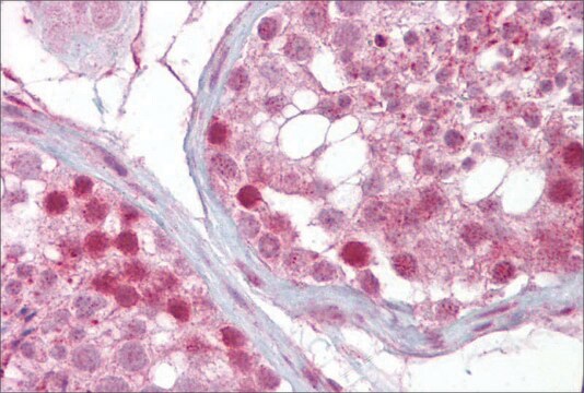 Anti-IFT88 antibody produced in rabbit affinity isolated antibody