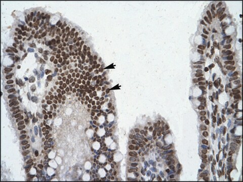 Anti-POU6F1 (AB1) antibody produced in rabbit affinity isolated antibody