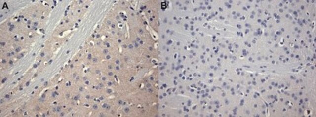 Anti-Adenosine Receptor A2a Antibody, clone 7F6-G5-A2 clone 7F6-G5-A2, Upstate&#174;, from mouse