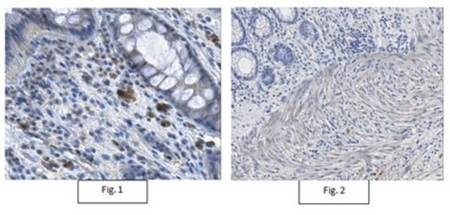 Anti-Dysferlin/DYSF Antibody, clone 10H3.1 clone 10H3.1, from mouse