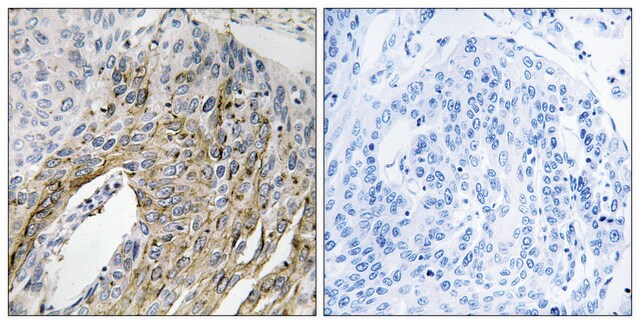 Anti-LONP2 antibody produced in rabbit affinity isolated antibody