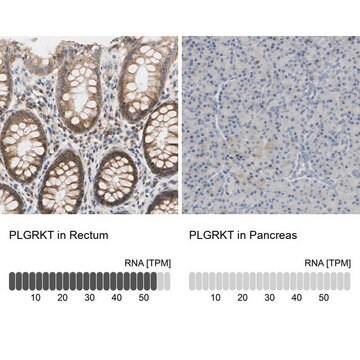 Anti-PLGRKT antibody produced in rabbit Ab1, Prestige Antibodies&#174; Powered by Atlas Antibodies, affinity isolated antibody, buffered aqueous glycerol solution