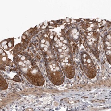 Anti-SNX16 antibody produced in rabbit Prestige Antibodies&#174; Powered by Atlas Antibodies, affinity isolated antibody, buffered aqueous glycerol solution, ab1