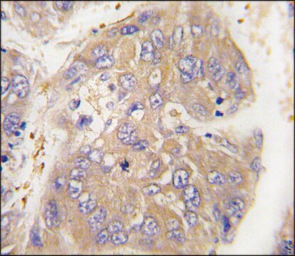 Anti-ARHGEF9 (center) antibody produced in rabbit affinity isolated antibody, buffered aqueous solution