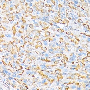 Anti-Sec23A antibody produced in rabbit