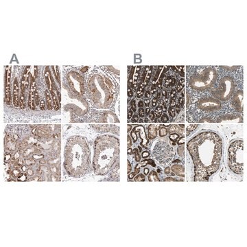 Anti-TUFM antibody produced in rabbit Prestige Antibodies&#174; Powered by Atlas Antibodies, affinity isolated antibody, buffered aqueous glycerol solution