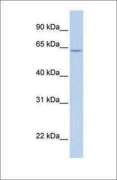 Anti-ARID5A (ab1) antibody produced in rabbit affinity isolated antibody